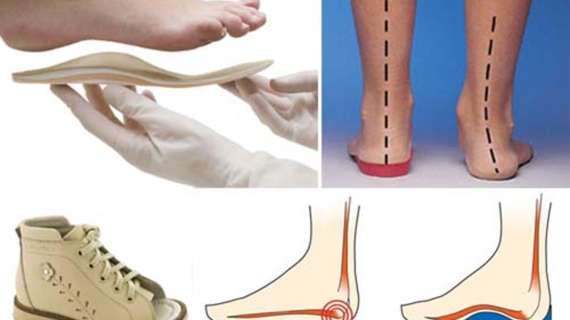 Uşaqlarınıza ayaqqabı alarkən bunlara DİQQƏT EDİN – FRANSIZ PEDİATRDAN XƏBƏRDARLIQ